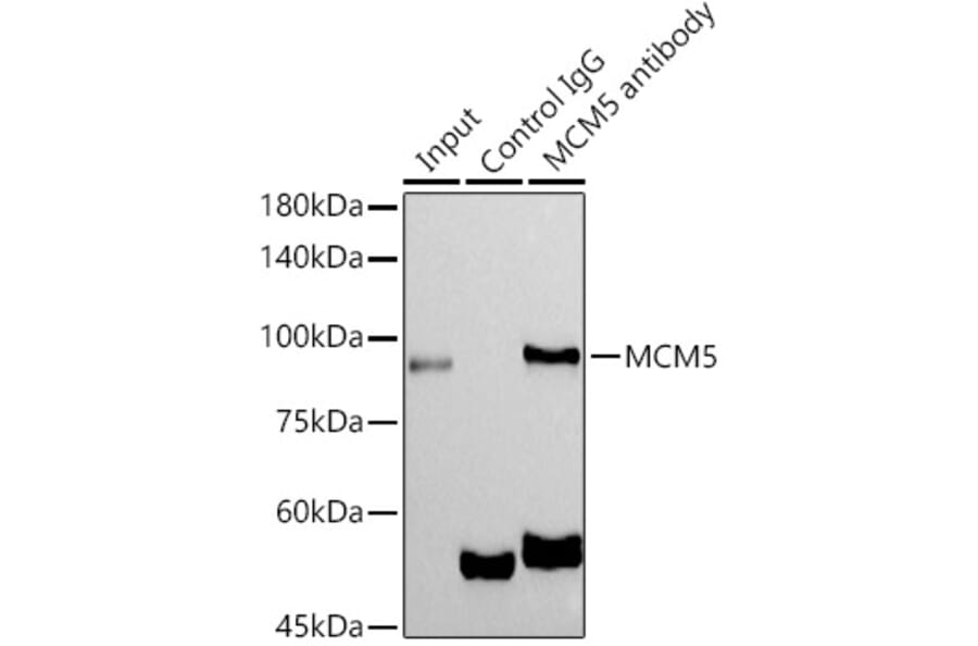 Western Blot - Anti-MCM5 Antibody [ARC1239] (A305293) - Antibodies.com