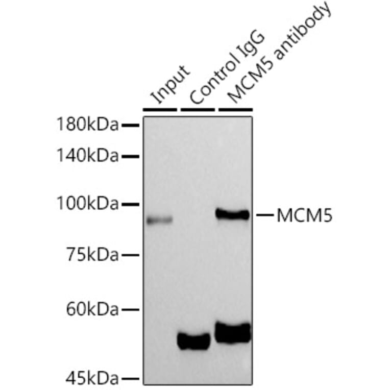 Western Blot - Anti-MCM5 Antibody [ARC1239] (A305293) - Antibodies.com
