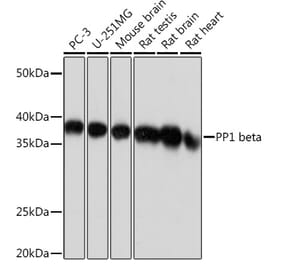Western Blot - Anti-PPP1CB Antibody [ARC0981] (A305294) - Antibodies.com