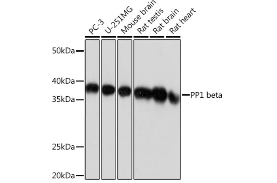 Western Blot - Anti-PPP1CB Antibody [ARC0981] (A305294) - Antibodies.com