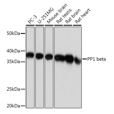 Western Blot - Anti-PPP1CB Antibody [ARC0981] (A305294) - Antibodies.com