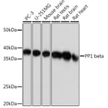 Western Blot - Anti-PPP1CB Antibody [ARC0981] (A305294) - Antibodies.com