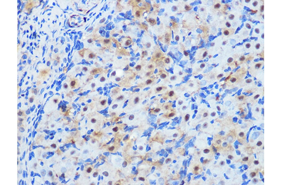 Immunohistochemistry - Anti-PPP1CB Antibody [ARC0981] (A305294) - Antibodies.com