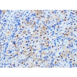 Immunohistochemistry - Anti-PPP1CB Antibody [ARC0981] (A305294) - Antibodies.com