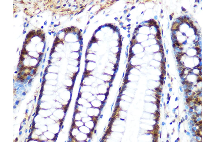 Immunohistochemistry - Anti-PPP1CB Antibody [ARC0981] (A305294) - Antibodies.com