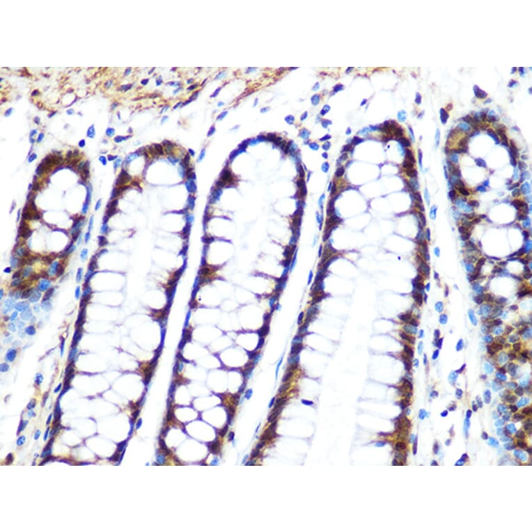 Immunohistochemistry - Anti-PPP1CB Antibody [ARC0981] (A305294) - Antibodies.com