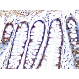 Immunohistochemistry - Anti-PPP1CB Antibody [ARC0981] (A305294) - Antibodies.com