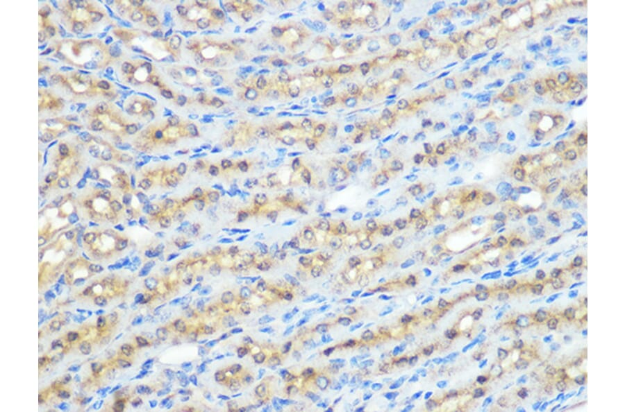 Immunohistochemistry - Anti-PPP1CB Antibody [ARC0981] (A305294) - Antibodies.com