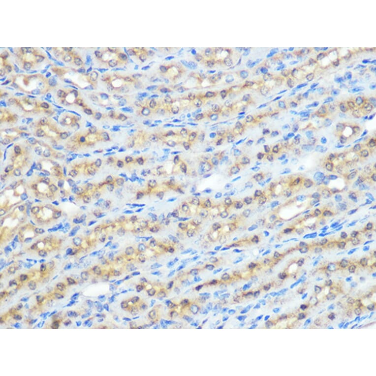 Immunohistochemistry - Anti-PPP1CB Antibody [ARC0981] (A305294) - Antibodies.com