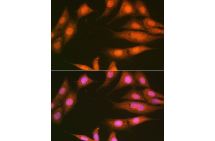 Immunofluorescence - Anti-PPP1CB Antibody [ARC0981] (A305294) - Antibodies.com