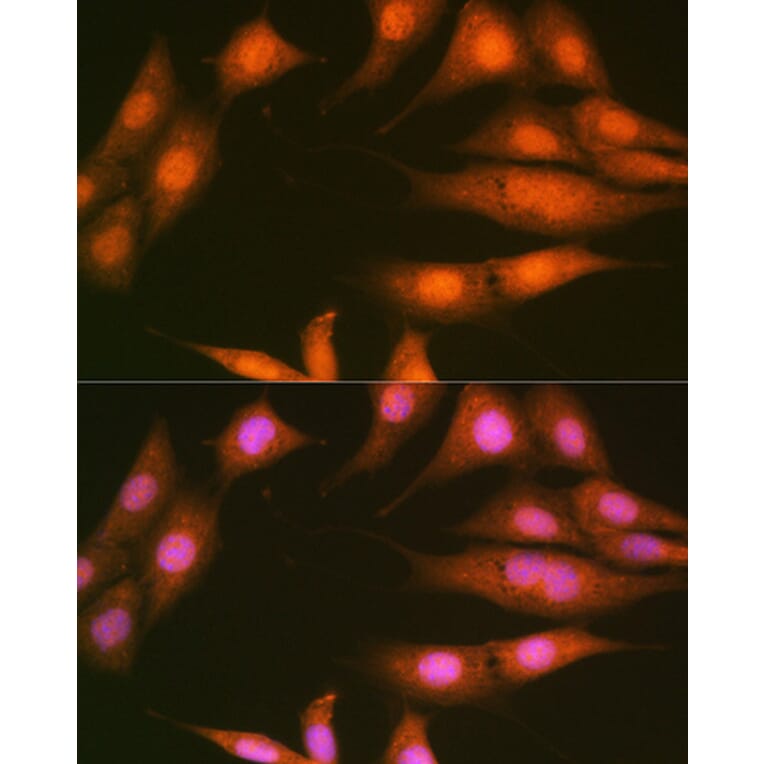 Immunofluorescence - Anti-PPP1CB Antibody [ARC0981] (A305294) - Antibodies.com