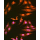 Immunofluorescence - Anti-PPP1CB Antibody [ARC0981] (A305294) - Antibodies.com