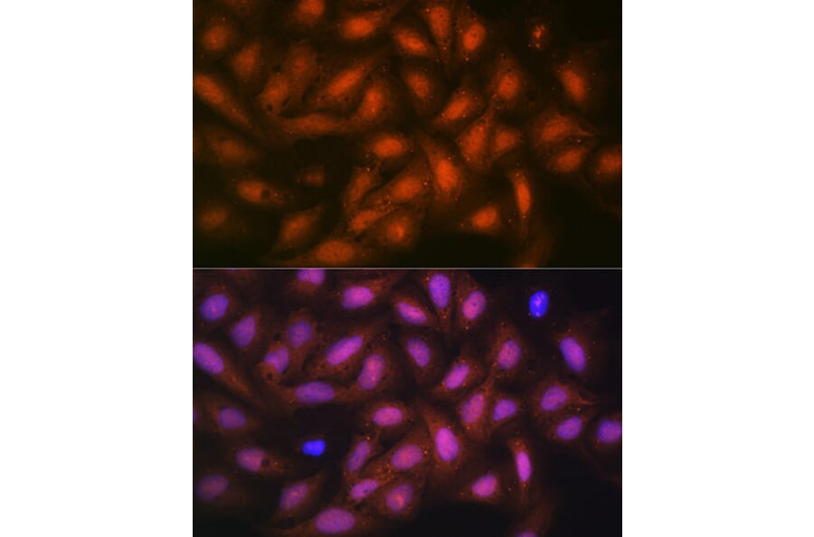 Immunofluorescence - Anti-PPP1CB Antibody [ARC0981] (A305294) - Antibodies.com
