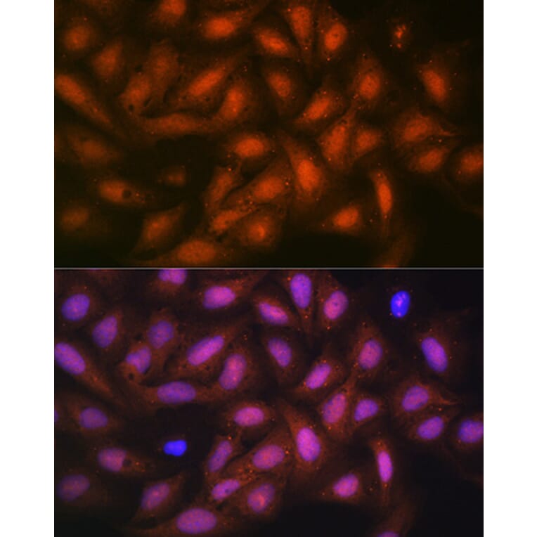 Immunofluorescence - Anti-PPP1CB Antibody [ARC0981] (A305294) - Antibodies.com