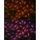 Immunofluorescence - Anti-PPP1CB Antibody [ARC0981] (A305294) - Antibodies.com