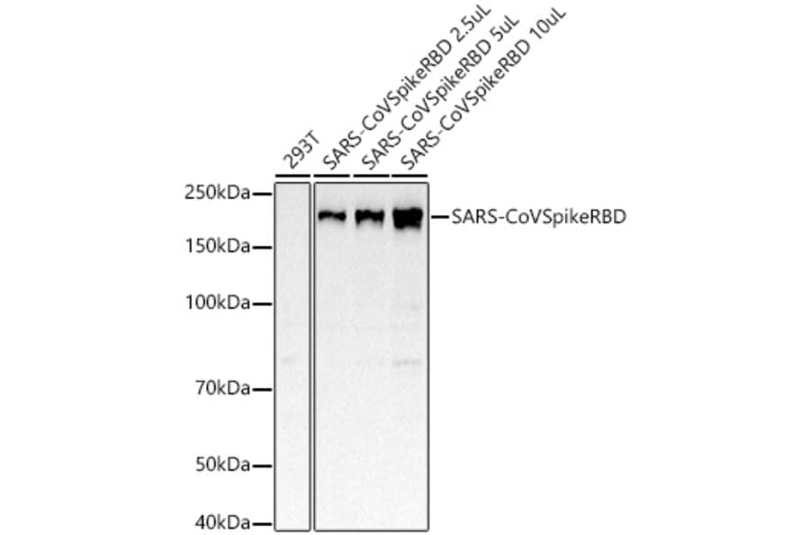 Western Blot - Anti-SARS spike glycoprotein RBD Antibody [ARC52567] (A305295) - Antibodies.com