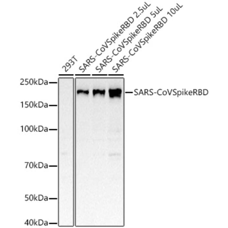 Western Blot - Anti-SARS spike glycoprotein RBD Antibody [ARC52567] (A305295) - Antibodies.com