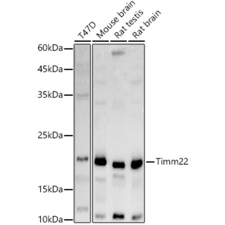 Western Blot - Anti-TIM22 Antibody (A305300) - Antibodies.com