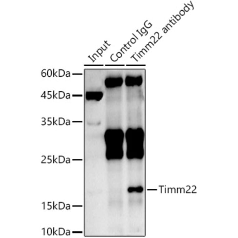 Western Blot - Anti-TIM22 Antibody (A305300) - Antibodies.com