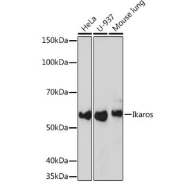 Western Blot - Anti-Ikaros Antibody [ARC0803] (A305301) - Antibodies.com
