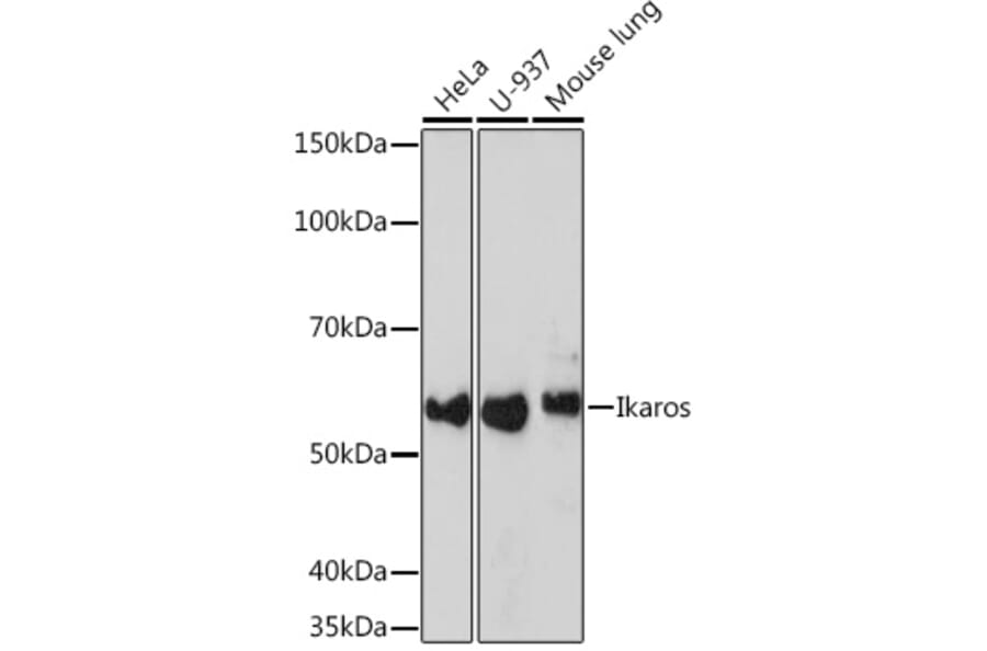 Western Blot - Anti-Ikaros Antibody [ARC0803] (A305301) - Antibodies.com