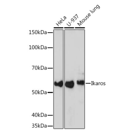 Western Blot - Anti-Ikaros Antibody [ARC0803] (A305301) - Antibodies.com