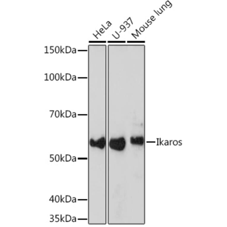 Western Blot - Anti-Ikaros Antibody [ARC0803] (A305301) - Antibodies.com