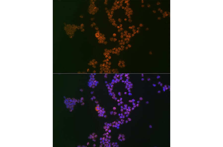 Immunofluorescence - Anti-Ikaros Antibody [ARC0803] (A305301) - Antibodies.com