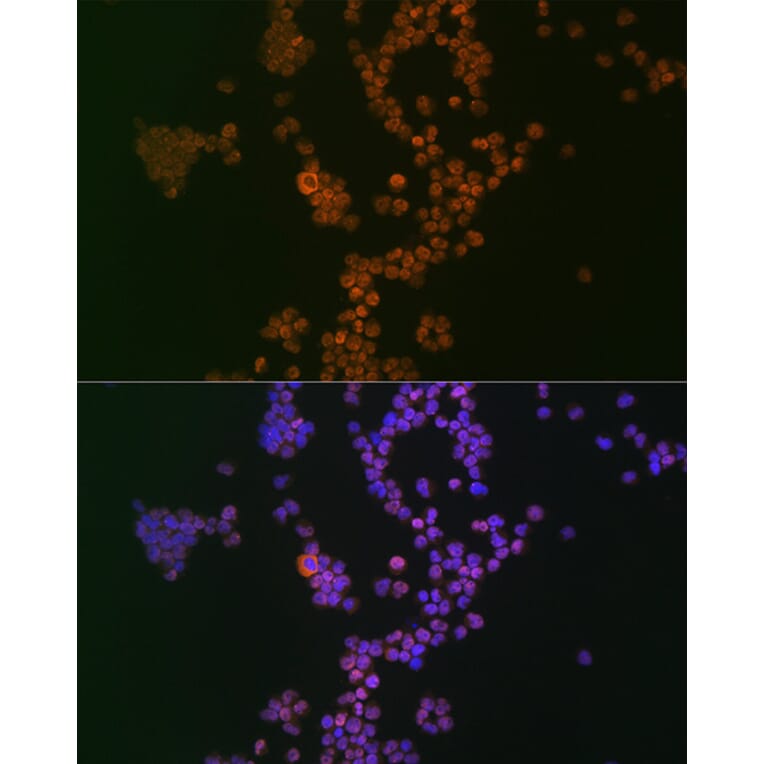 Immunofluorescence - Anti-Ikaros Antibody [ARC0803] (A305301) - Antibodies.com