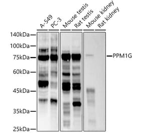 Western Blot - Anti-PPM1G Antibody [ARC2947] (A305302) - Antibodies.com