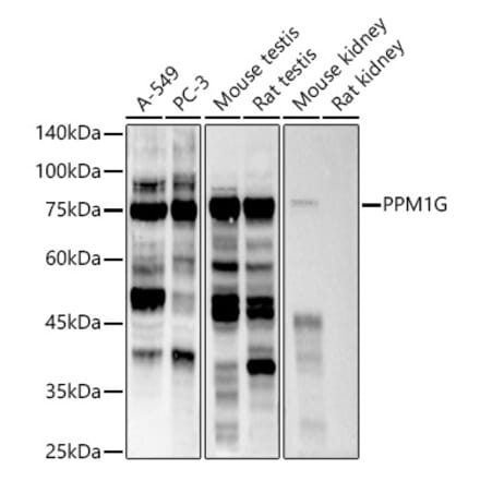 Western Blot - Anti-PPM1G Antibody [ARC2947] (A305302) - Antibodies.com