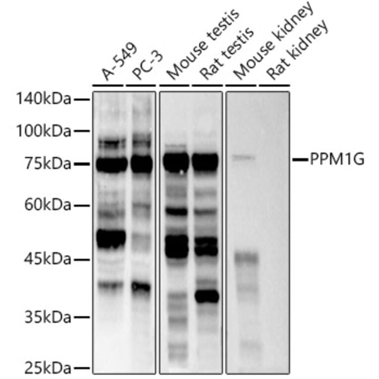 Western Blot - Anti-PPM1G Antibody [ARC2947] (A305302) - Antibodies.com