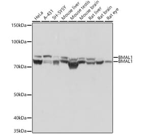 Western Blot - Anti-BMAL1 Antibody [ARC1101] (A305303) - Antibodies.com
