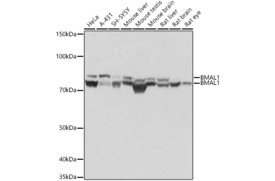 Western Blot - Anti-BMAL1 Antibody [ARC1101] (A305303) - Antibodies.com