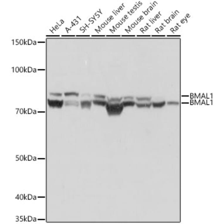 Western Blot - Anti-BMAL1 Antibody [ARC1101] (A305303) - Antibodies.com