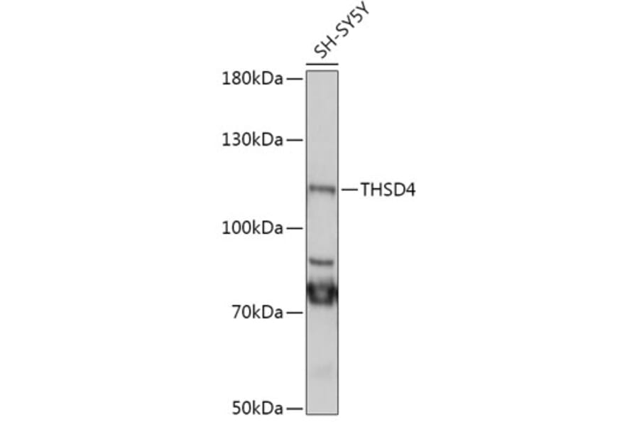 Western Blot - Anti-THSD4 Antibody (A305304) - Antibodies.com