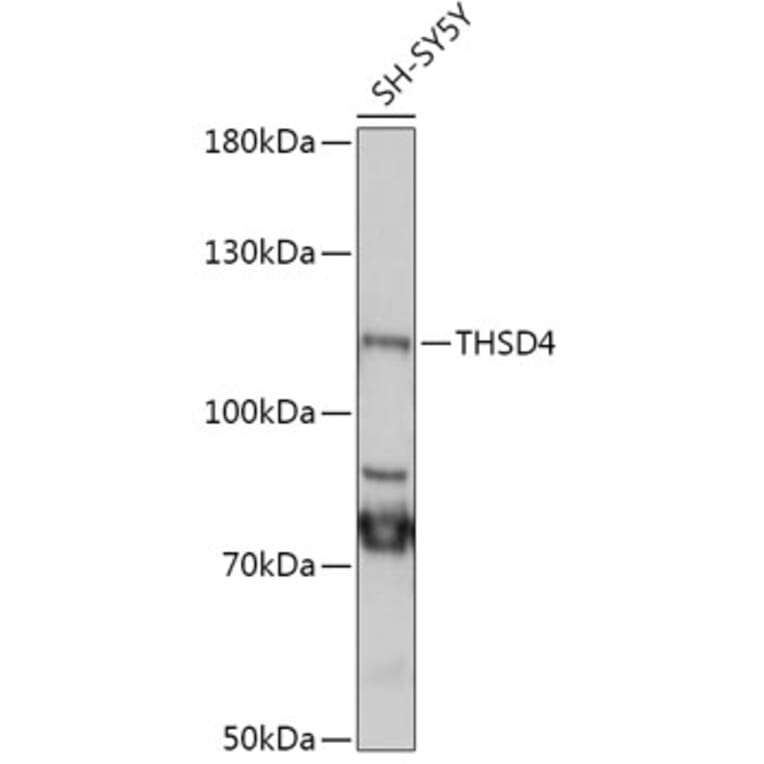 Western Blot - Anti-THSD4 Antibody (A305304) - Antibodies.com