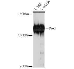 Western Blot - Anti-Daxx Antibody (A305305) - Antibodies.com
