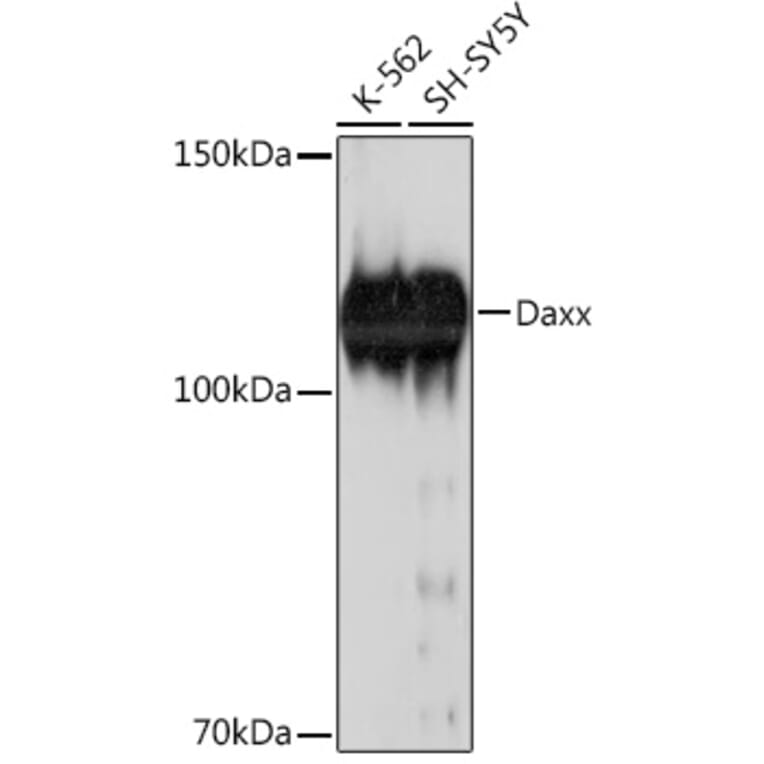 Western Blot - Anti-Daxx Antibody [ARC2220] (A305305) - Antibodies.com