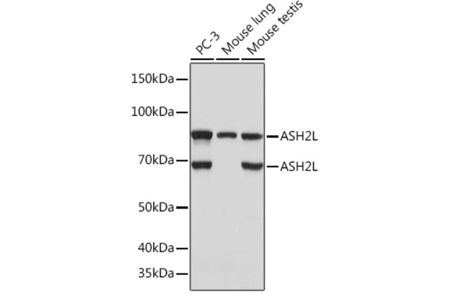 Western Blot - Anti-ASH2L Antibody [ARC0326] (A305306) - Antibodies.com