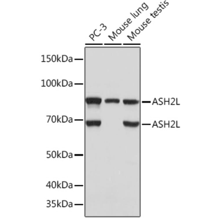 Western Blot - Anti-ASH2L Antibody [ARC0326] (A305306) - Antibodies.com