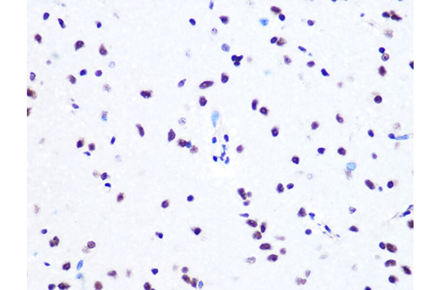 Immunohistochemistry - Anti-ASH2L Antibody [ARC0326] (A305306) - Antibodies.com