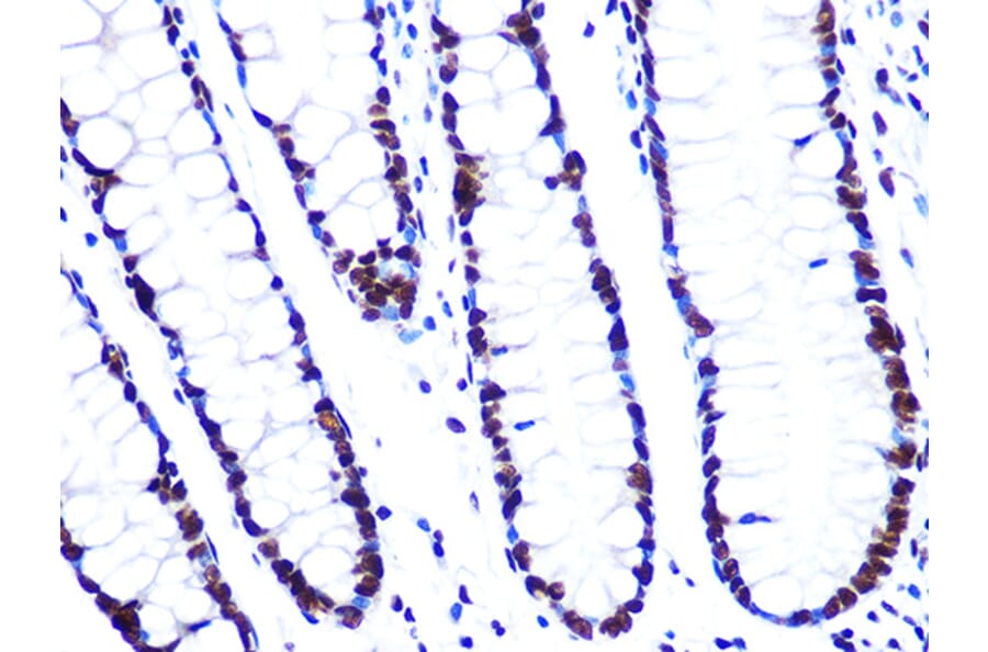 Immunohistochemistry - Anti-ASH2L Antibody [ARC0326] (A305306) - Antibodies.com