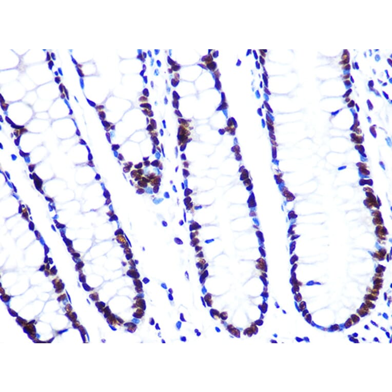 Immunohistochemistry - Anti-ASH2L Antibody [ARC0326] (A305306) - Antibodies.com