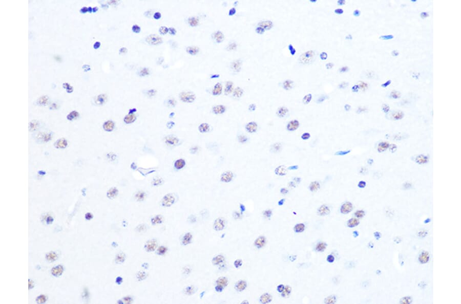 Immunohistochemistry - Anti-ASH2L Antibody [ARC0326] (A305306) - Antibodies.com
