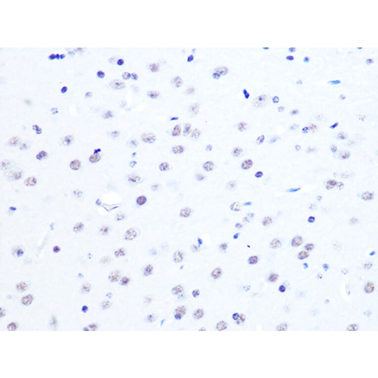 Immunohistochemistry - Anti-ASH2L Antibody [ARC0326] (A305306) - Antibodies.com