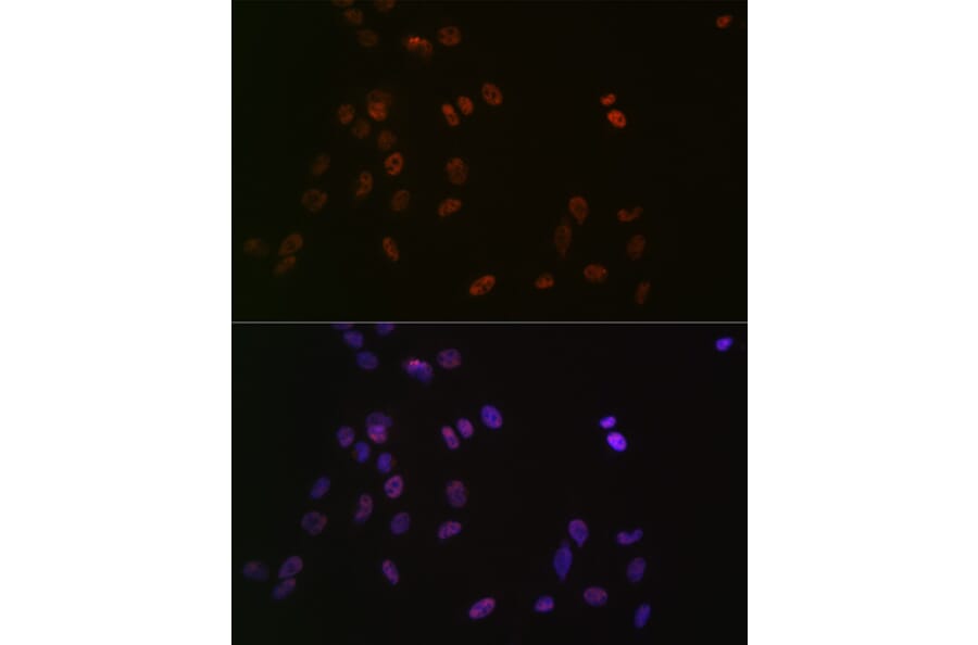 Immunofluorescence - Anti-ASH2L Antibody [ARC0326] (A305306) - Antibodies.com