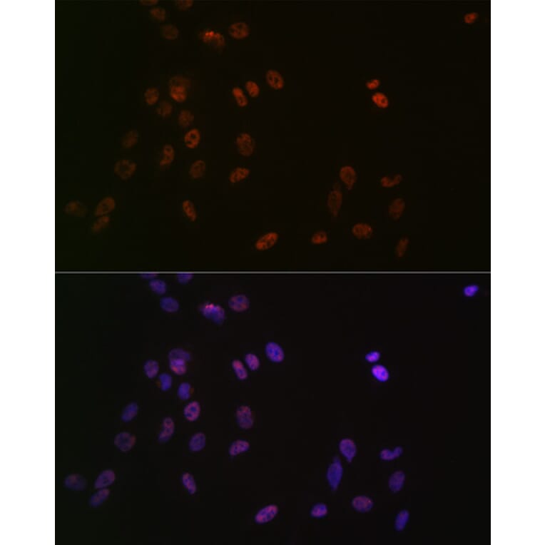 Immunofluorescence - Anti-ASH2L Antibody [ARC0326] (A305306) - Antibodies.com