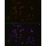 Immunofluorescence - Anti-ASH2L Antibody [ARC0326] (A305306) - Antibodies.com