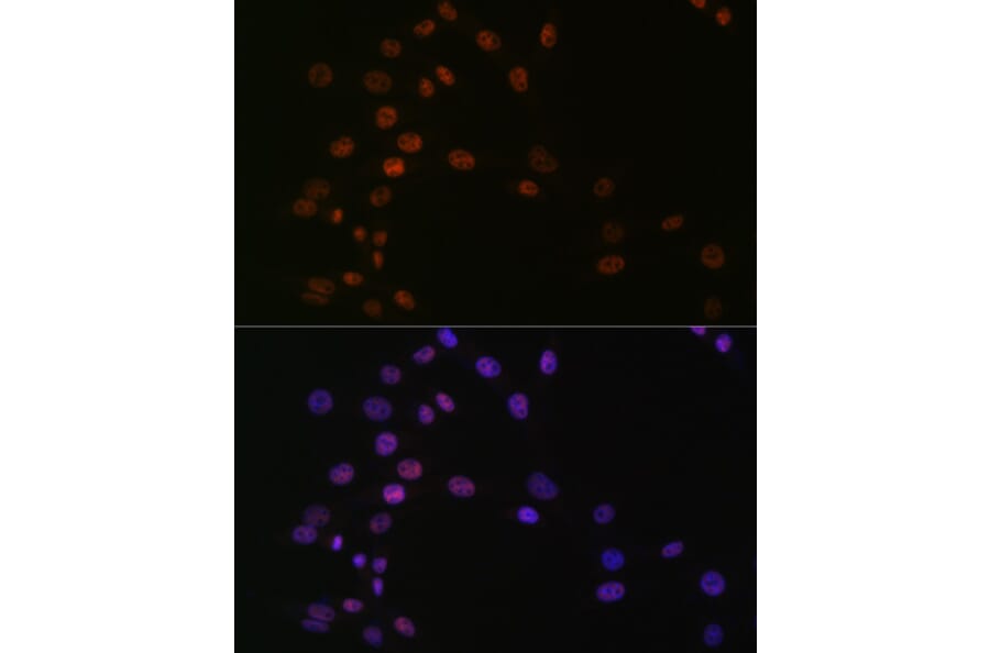 Immunofluorescence - Anti-ASH2L Antibody [ARC0326] (A305306) - Antibodies.com